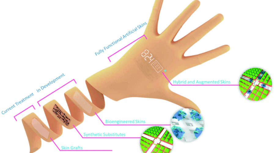 Tissue Engineered Skin Substitute Market