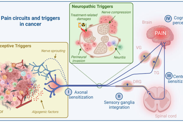Cancer Pain: Integrating Medical and Supportive Care